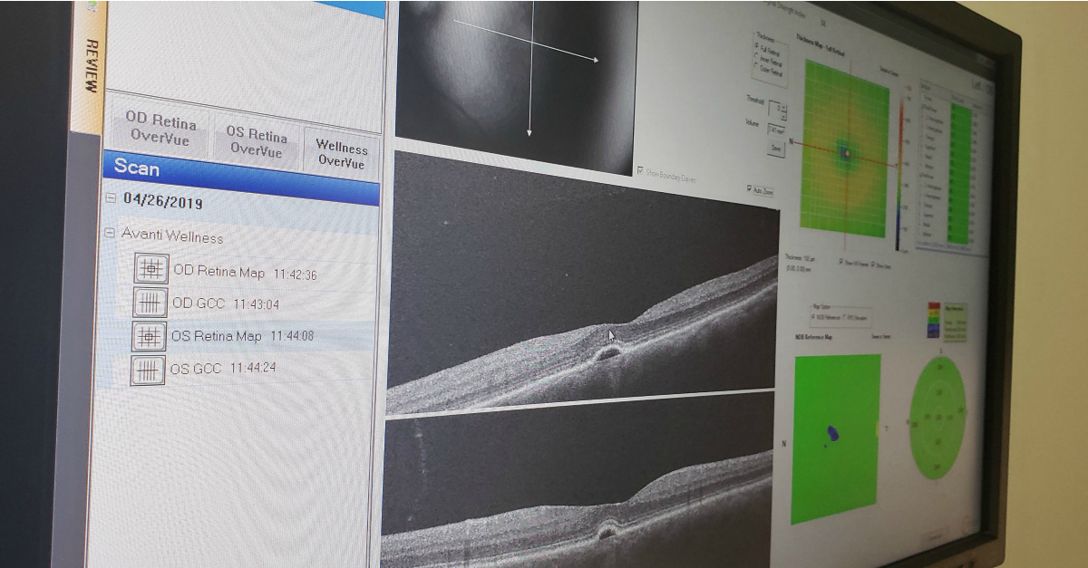 Dr. Littlefield's retina eye scan technology 
